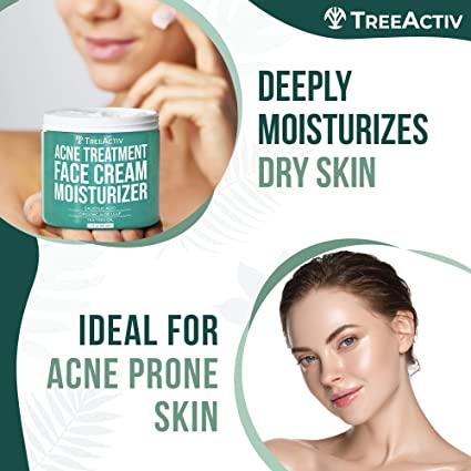 Acne Eliminating Face Cream