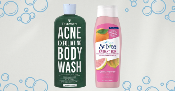 Acne-Prone Skin Savior: A Look at TreeActiv Acne Body Wash VS St. Ives Radiant Skin Body Wash