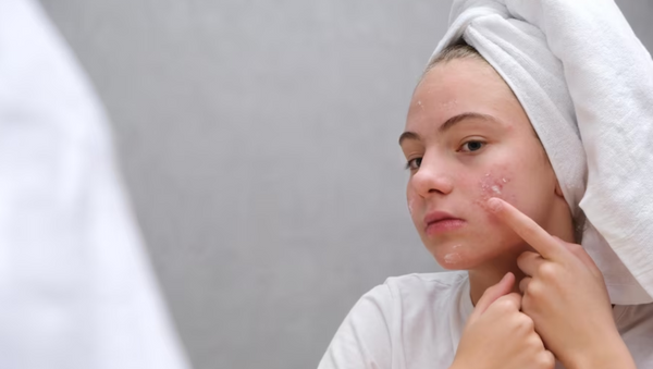 Clear Skin Ahead: 8 Incredible Benefits of Acne Cream for Your Face