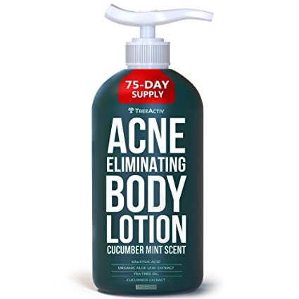 Acne Eliminating Body Lotion, Cucumber Mint