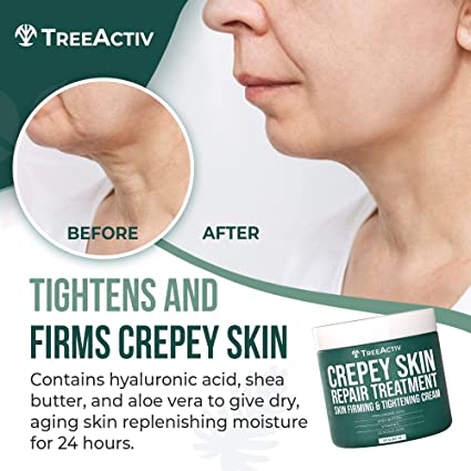 Crepey Skin Repair Treatment