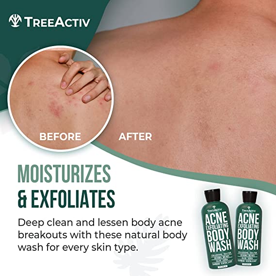 TreeActiv Anti-Acne Exfoliating Body Wash