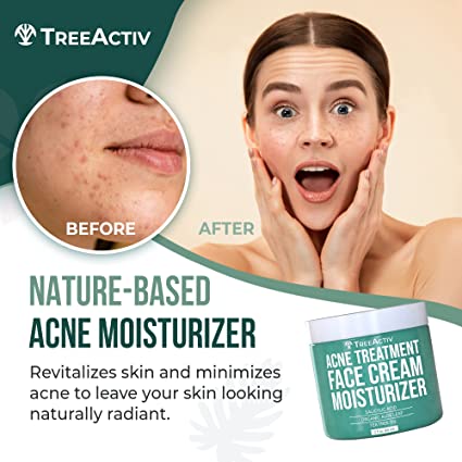 Acne Eliminating Face Cream