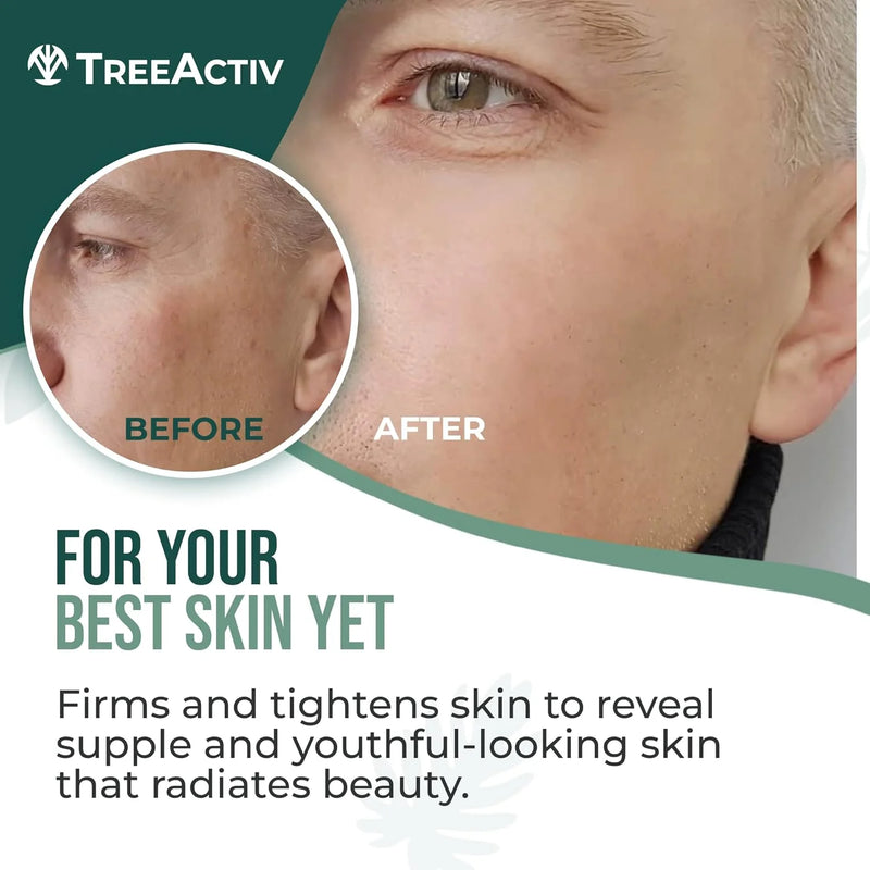 TreeActiv Retinol Cream, Deep Wrinkle Remover Cream, Retinol and Hyaluronic Acid, 2 fl oz, 60-Day Supply